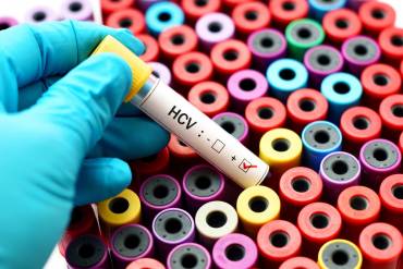 Badanie HCV – czym jest, kiedy się je wykonuje, gdzie można je wykonać?